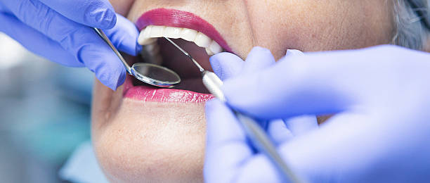 Best Emergency Dental Services for Seniors in Bluffdale, UT